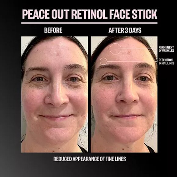Peace Out Retinol Face Stick - NIB - Picture 2 of 7